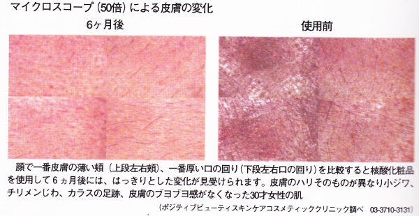 核酸でお肌が若返ります